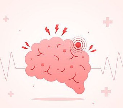 Mengenal Golden Period pada Stroke, Waktu Krusial dalam Penanganan Stroke