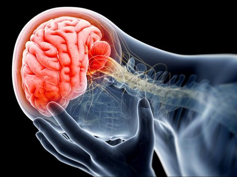 Mengenal Golden Period pada Stroke, Waktu Krusial dalam Penanganan Stroke