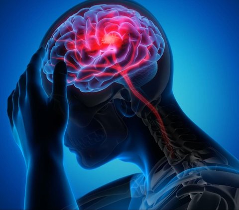 Peringatan Hari Stroke Sedunia 29 Oktober, Berikut Tema dan Sejarahnya