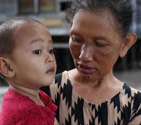 Kisah Sang 'Suster Apung' yang Tetap Mengabdi Meski Sudah Pensiun, 40 Tahun Lebih Naik Kapal Kecil Keliling Pulau Terpencil Demi Obati Orang