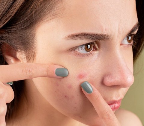 6 Simple Habits that Can Damage the Skin, Must Be Avoided Immediately