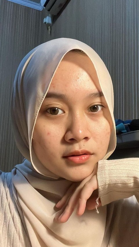 Ungkap Ingin Percaya Diri Tampil Tanpa Make Up