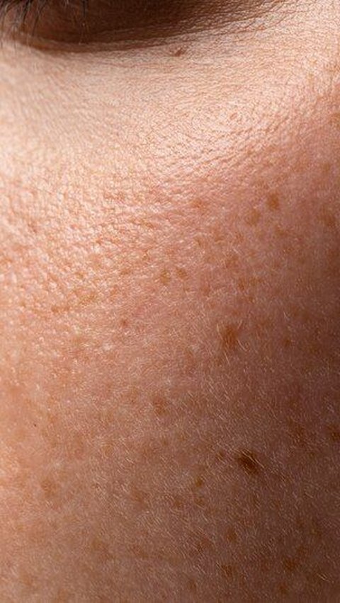 Pori-pori wajah adalah bagian penting dari kulit kita yang berfungsi mengeluarkan keringat dan minyak.
