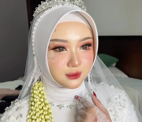 Bride's Face Injured Due to Accident Before Wedding, MUA's Makeup Transformation is Amazing