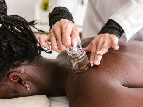 Benefits and Recommended Cupping Time, Prophet's Treatment that is Beneficial for Health