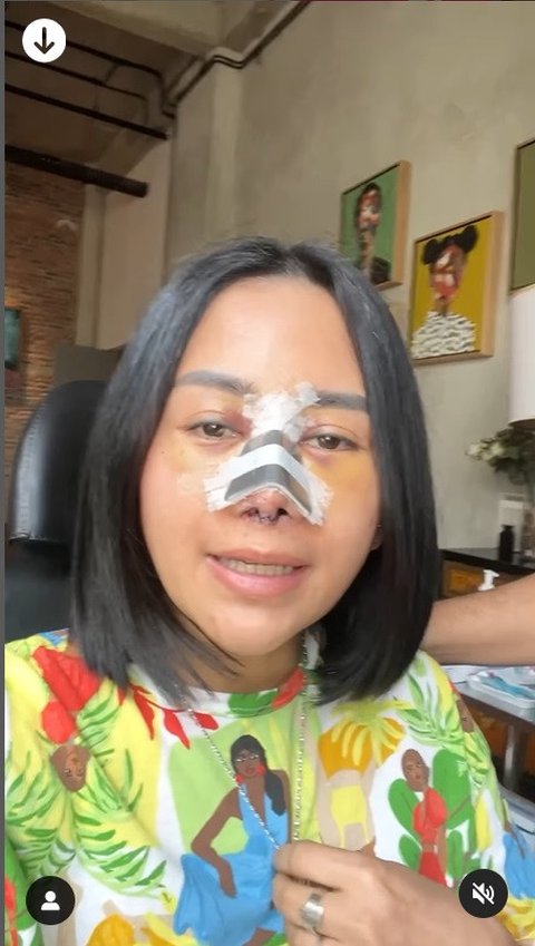 Santai Meski Tuai Cibiran, Potret Farida Nurhan Kembali Oplas Hidung Demi Penampilan Maksimal