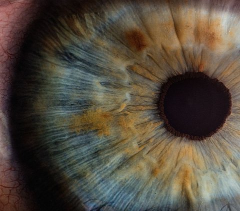 Ini Pasien Pertama di Dunia yang Lakukan Transplantasi Mata Utuh, Begini Hasilnya