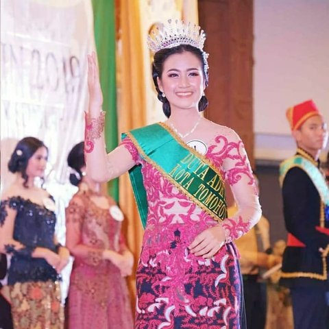 Potret Cantik Rinoa Aurora Pacar Leon Dozan yang Kini Sedang Jadi Sorotan, Diduga Alami Penganiayaan