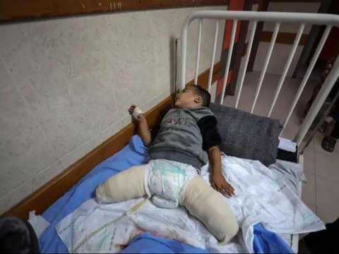 Kisah Pilu Bocah Tiga Tahun di Gaza, Bom Israel Renggut Semua Keluarganya dan Kini Harus Hidup Tanpa Kaki