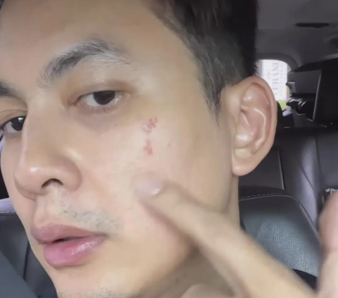 9 Potret Terbaru Kiki Farrel Dibully Jelek Sampai Kena Azab, Wajah Dinilai Beda Banget