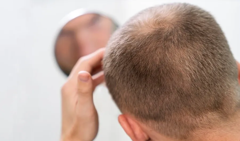Pengikatan rambut terlalu ketat juga dapat menyebabkan kerusakan pada folikel rambut.<br>