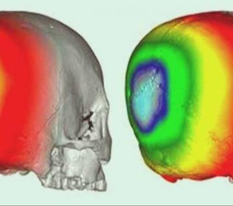 Pain, 1,500-Year-Old Japanese Tribe Performs Baby Head Modification Practice to Make it Unique