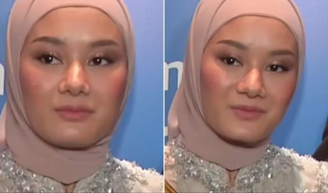 Dalam sorotan kamera wartawan, Dinda Hauw, yang dikenal memiliki wajah flawless, tiba-tiba terlihat berbeda.