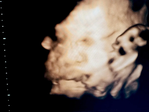 Atta Halilintar Unggah Foto USG Anak Kedua, Ramai Disebut Mirip Ameena