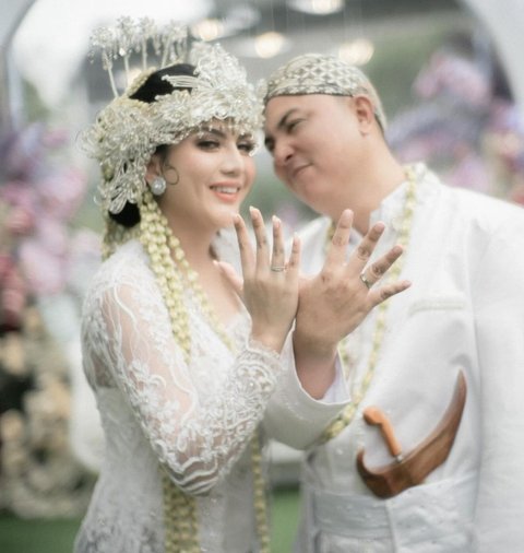 Memperlihatkan Cincin Kawin