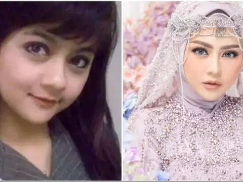 9 Portraits of Dangdut Singers Before and After Thread Planting