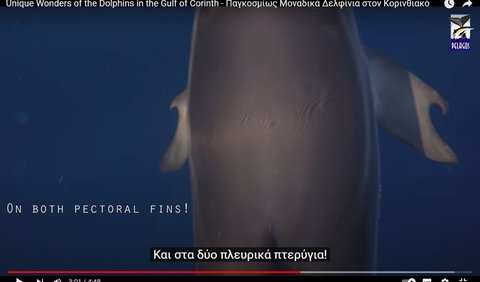 Cetacea, yang mencakup mamalia laut seperti paus dan lumba-lumba, telah mengembangkan anggota badan depan yang unik dengan lebih banyak falang atau tulang jari dibandingkan mamalia lain.