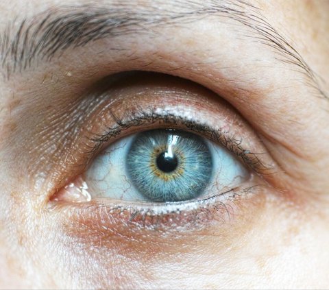 Tips from a Doctor to Overcome Various Skin Problems around the Eyes, to Prevent Wrinkles Easily