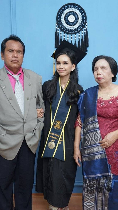 Kisah Septiani Hirawati jadi Mahasiswi Terbaik Lulus Cumlaude, Ibu Bapaknya Tunanetra Hadiri Wisuda Begitu Bangga 