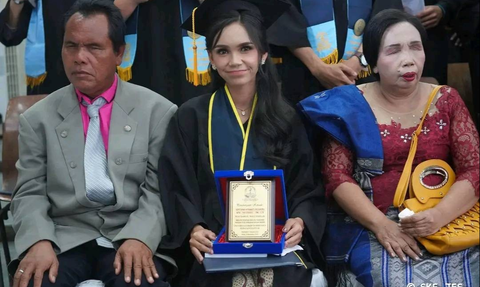 Kisah Septiani Hirawati jadi Mahasiswi Terbaik Lulus Cumlaude, Ibu Bapaknya Tunanetra Hadiri Wisuda Begitu Bangga
