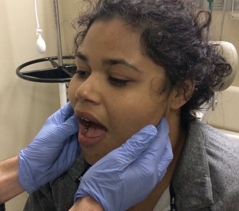 Patient Goes Viral Unable to Speak After Laughing Hysterically, Rushed to the Emergency Room