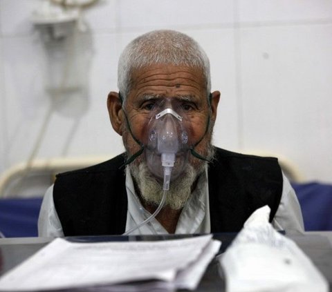 4 Cara Ini Bantu Putus Rantai Darurat TBC di Indonesia