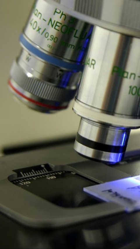 Begini Penampakan Setetes Sperma Dilihat Pakai Mikroskop, Ada Jutaan Calon Manusia