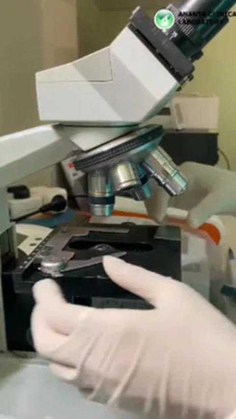 Video yang memperlihatkan potret setetes sel sperma menggunakan mikroskop berhasil mencuri perhatian. <br>
