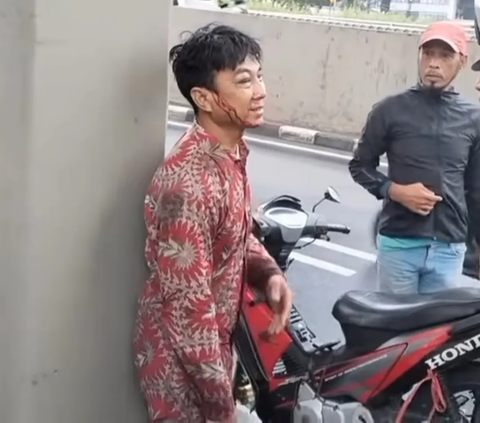 Miris Pengendara Motor Kecelakaan, Handphone dan Dompet Malah Dicuri Orang yang Bantu