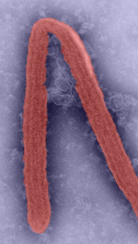 Marburg, Virus Mematikan dari Afrika