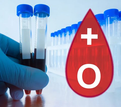 Golongan darah O disebut golongan darah universal karena tak mengandung antigen, sehingga bisa didonorkan ke semua golongan darah.