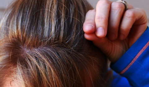Hukum Memotong Rambut dan Kuku bagi Orang yang Berkurban: Larangan