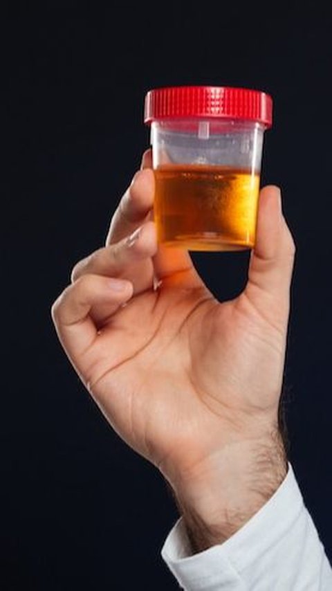 Hasil tes urine menunjukkan MS positif metamfetamin.