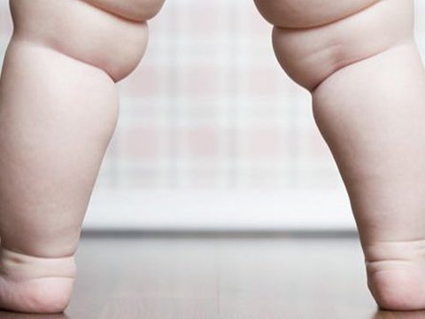 Hindari Makanan Ini Supaya Anak Tidak Mengalami Obesitas