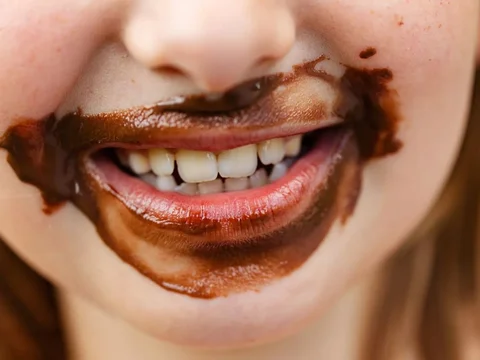 Penyakit ini kerap terjadi pada anak yang terlalu banyak mengonsumsi makanan atau minuman yang memiliki kandungan gula cukup tinggi. Sehingga tumbuh bakteri pada gigi dan menyebabkan karies.
