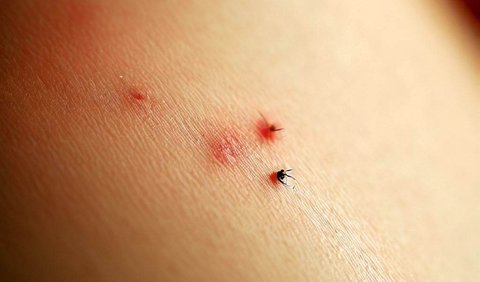 Nyamuk menjadi vektor persebaran penyakit karena peran mereka dalam penularan patogen dari satu individu ke individu lainnya.