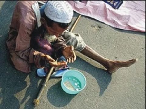 5 Pengemis yang Ternyata Punya Harta Melimpah di Indonesia