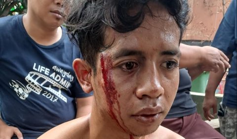 Atas kejadian ini, kata Tribuana, Ridho pun segera diberikan pertolongan pertama dan dikembalikan ke tempat kerjanya sebagai tukang cuci steam kendaraan oleh anggota kepolisian.