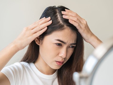 Stres Bisa Menyebabkan Rambut Rontok, Mitos atau Fakta Sih?