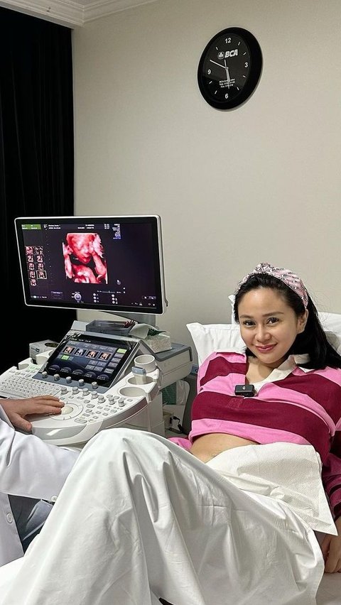 Aksinya Buka Donasi untuk Lahiran Jadi Sorotan, Ini Profil Denise Chariesta