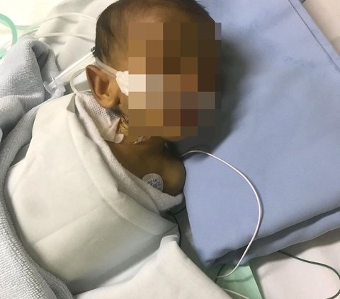 Miris Bayi 1 Bulan Kritis Diduga karena Perawat RSAB Harapan Kita Lalai, 'Menteri Kesehatan Wajib Periksa para Perawat'