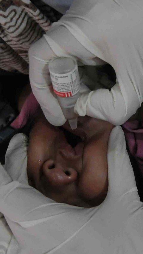 FOTO: Cegah Diare Berat, Kemenkes Gelar Imunisasi Rotavirus Secara Nasional