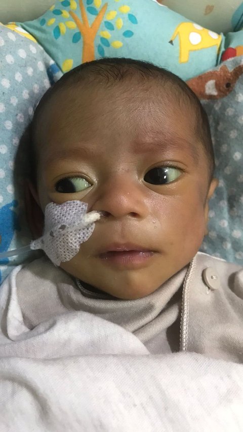 Suster Salah Kasih Susu, Bayi Dua Bulan Kritis Hingga Gizi Buruk