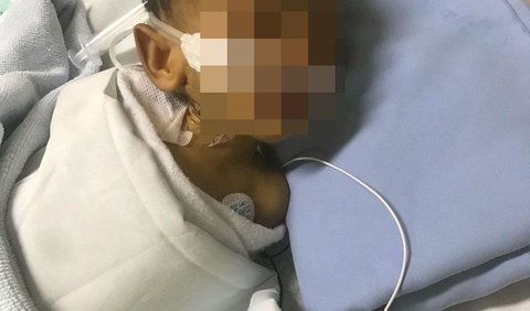 Kemudian, sekitar jam 15.00 WIB ibu dari si bayi kembali melaporkan kepada perawat karena melihat darah keluar dari kantong colostomy anaknya.