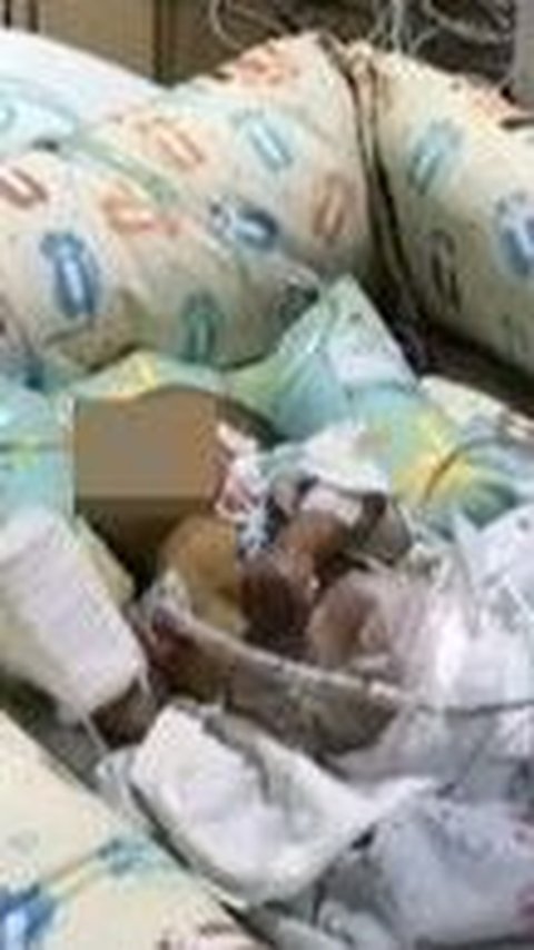 Karena tak segera ditangani, si ibu bayi mengatakan jika anaknya yang baru berusia 1 bulan 27 hari itu mengalami pendarahan di kepalanya dan harus menjalani operasi.