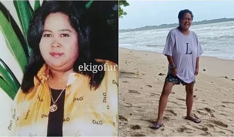 Suti Karno juga mengalami perubahan drastis akibat penyakit diabetes.