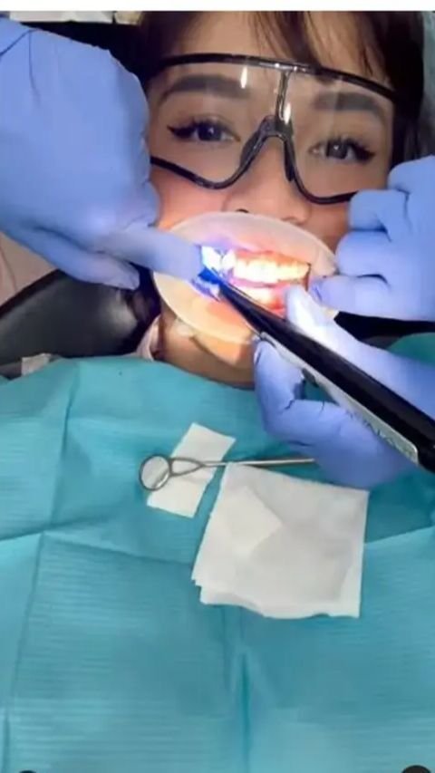 Chelsea Olivia membagikan beberapa momen penting dalam perawatan giginya.