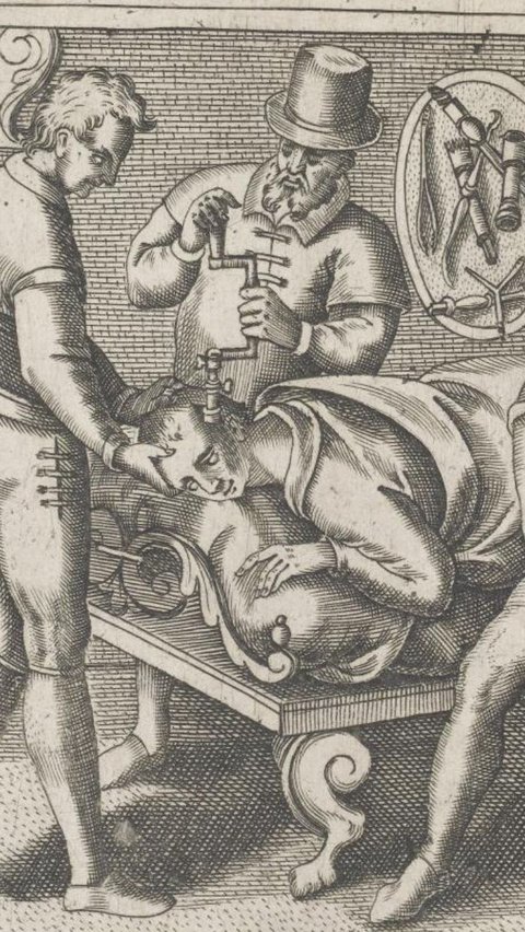 Trepanasi