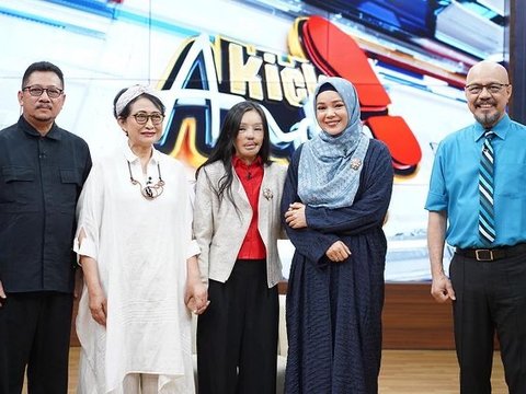 Pernah Jadi Korban KDRT Penyiraman Air Keras, Begini Kabar Terbaru Lisa ‘Face Off’