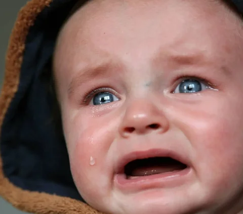 Viral Bayi Dikerokin Sampai Merah, Meski Pakai Bawang, Berbahayakah? Ini Kata Pakar